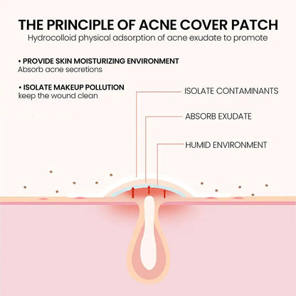 Star Acne Pimple Patch