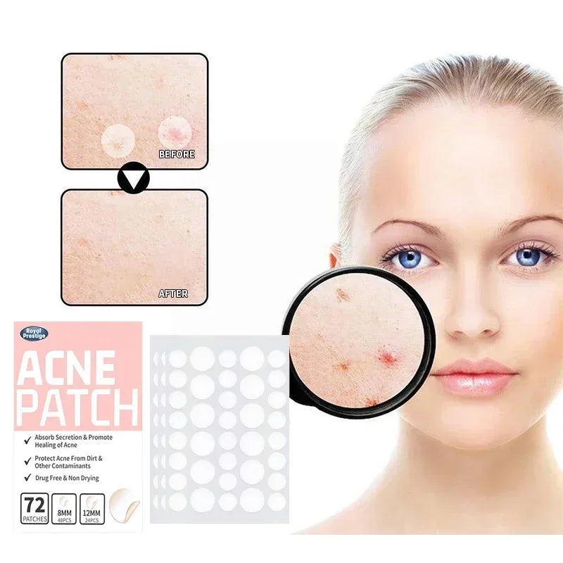 Invisible Anti-Acne Hydrocolloid Pimple Patches